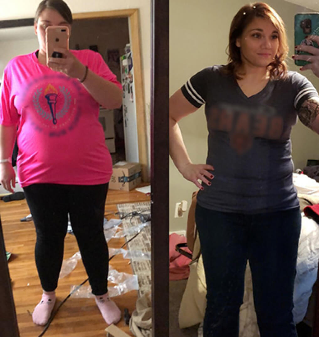 Side by side photos of a woman that show her weight loss after bariatric surgery